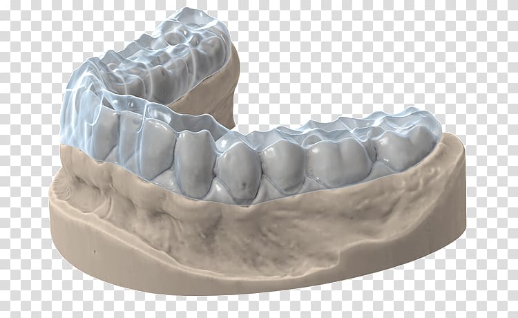 3D scanner Tooth Computer Software scanner 3D printing, Occlusal Splint transparent background PNG clipart