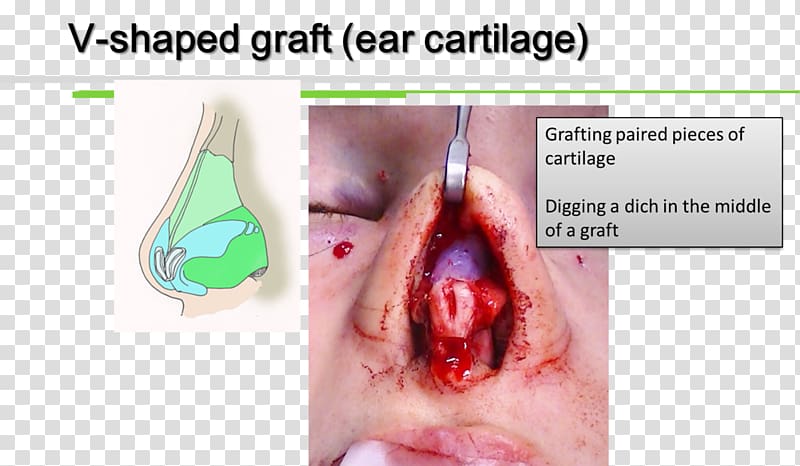 Thumb Close-up Shoulder Organism Stomach, cartilage transparent background PNG clipart