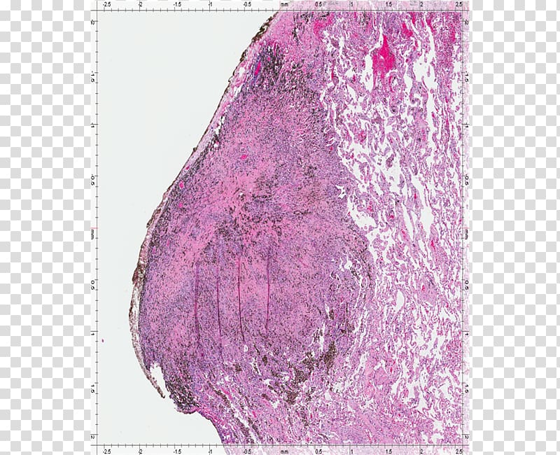 Silk Pink M, Pleural Cavity transparent background PNG clipart