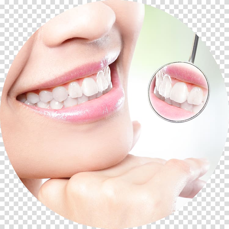 Tooth whitening Cosmetic dentistry Human tooth, crown transparent background PNG clipart