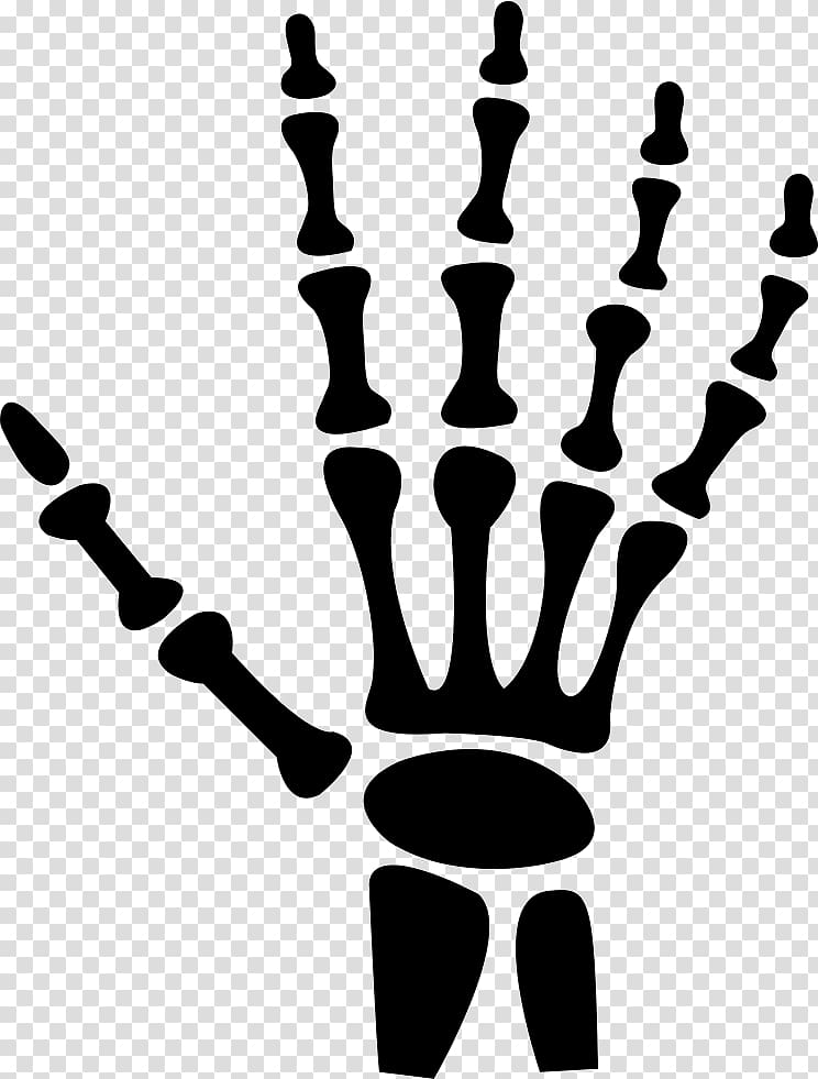 Hand X-ray Radiology Human body, hand transparent background PNG clipart