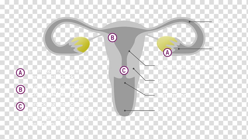Hormone Etonogestrel birth control implant Antibabypille Uterus, Ethinylestradiollevonorgestrel transparent background PNG clipart