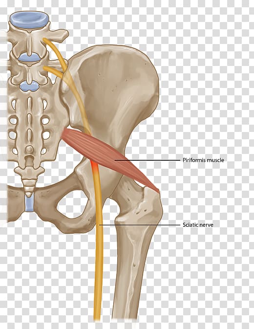 Piriformis syndrome Piriformis muscle Back pain Injection Surgery, others transparent background PNG clipart