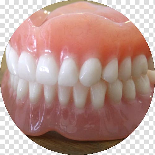 Dentures Prosthesis Dentistry Dental implant Tooth, crown transparent background PNG clipart