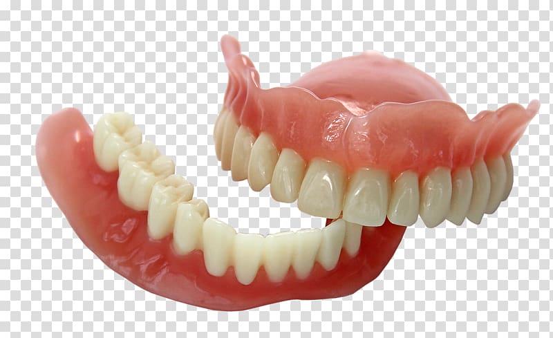 orthodontist denture, 3D printing Dentures EnvisionTEC Dentistry, Dental transparent background PNG clipart