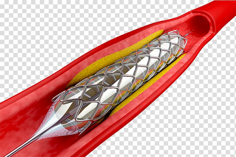 Angioplasty Percutaneous coronary intervention Stenting Coronary stent Balloon catheter, heart transparent background PNG clipart