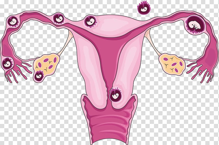 Ectopic pregnancy Uterus Tubal ligation Ultrasonography, others transparent background PNG clipart