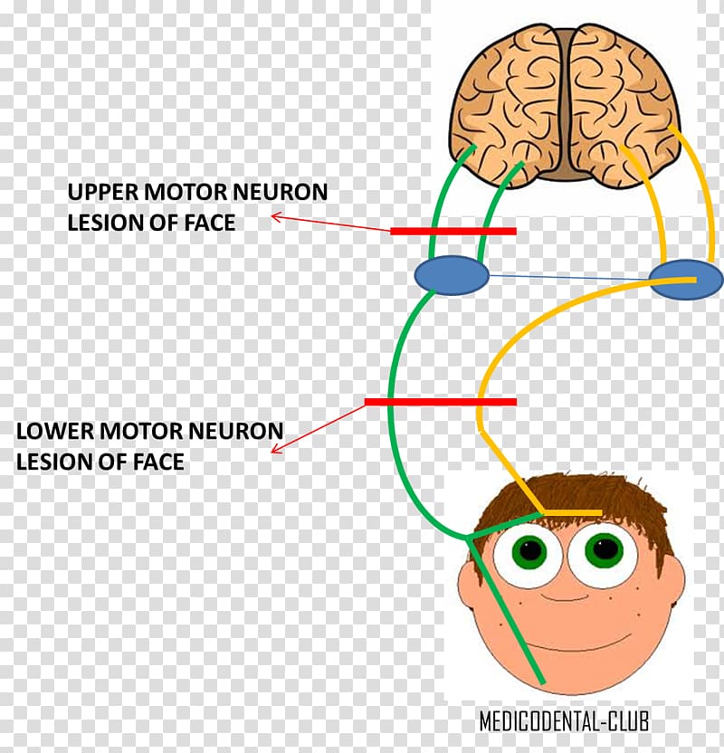 Lower motor neuron lesion Facial nerve Upper motor neuron lesion, cranial nerve transparent background PNG clipart