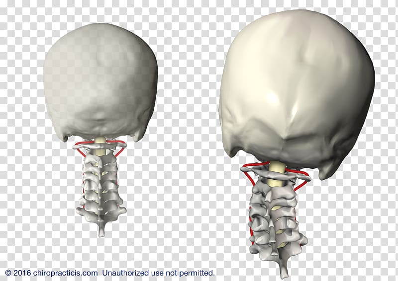 Vertebral subluxation Vertebral column Cervical vertebrae Chiropractic, others transparent background PNG clipart