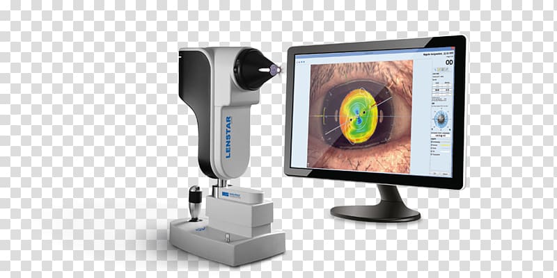 Ophthalmology Cataract surgery Eye examination, Eye transparent background PNG clipart
