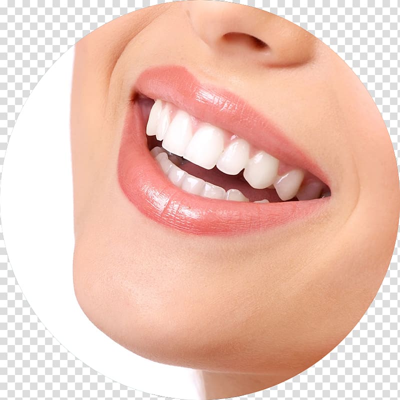 Tooth whitening Dentistry Human tooth, bridge transparent background PNG clipart