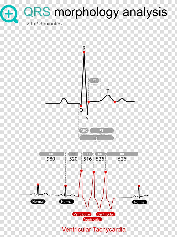 Line Point Angle, Ecg Monitor transparent background PNG clipart