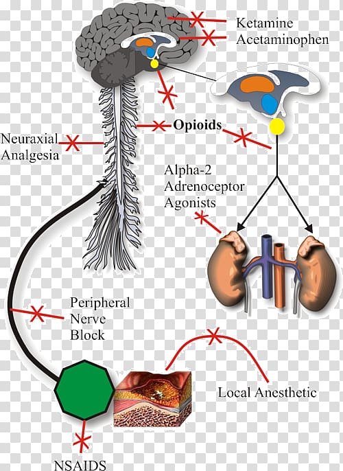 Analgesic Pain management Anesthesia Ketamine, Opioid Receptor transparent background PNG clipart