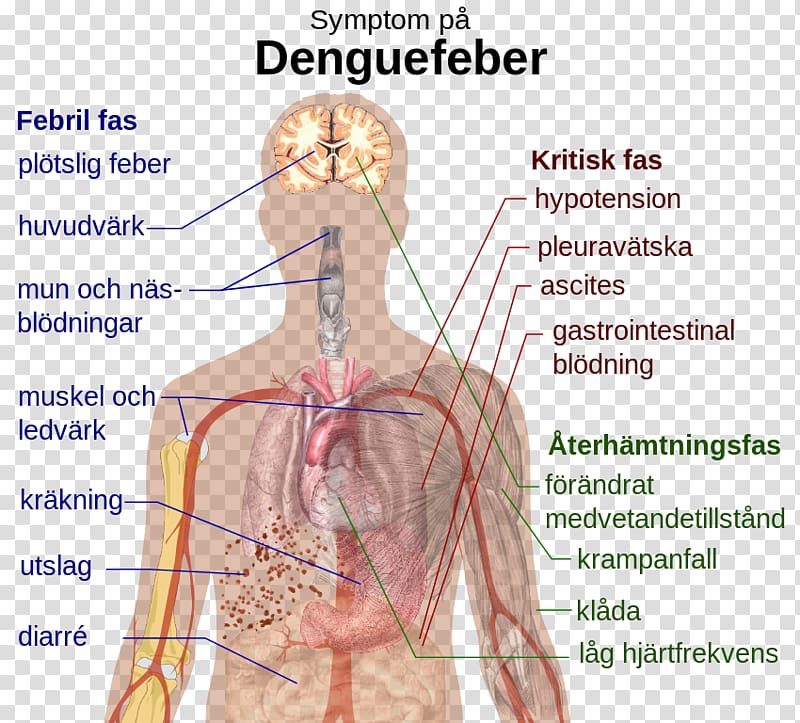 Dengue virus Symptom Viral hemorrhagic fever, health transparent background PNG clipart