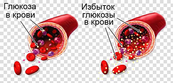 Blood Sugar Hypoglycemia Diabetes mellitus Hyperglycemia, blood transparent background PNG clipart