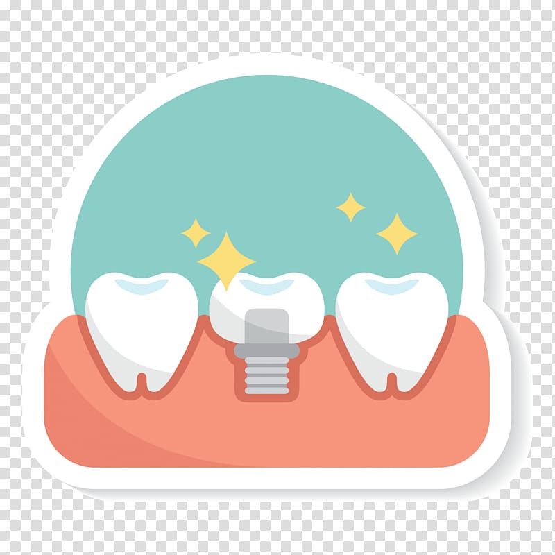 Dental implant Edentulism Dental extraction Dentistry , Dental implant transparent background PNG clipart