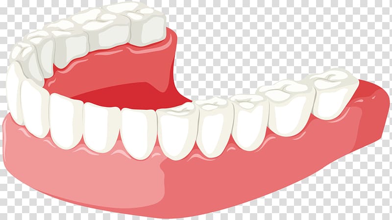 Tooth Jaw Dentures , dent transparent background PNG clipart