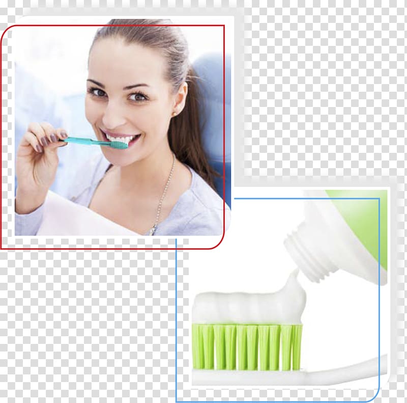 Cosmetic dentistry Oral hygiene Periodontal disease, aloe vera transparent background PNG clipart