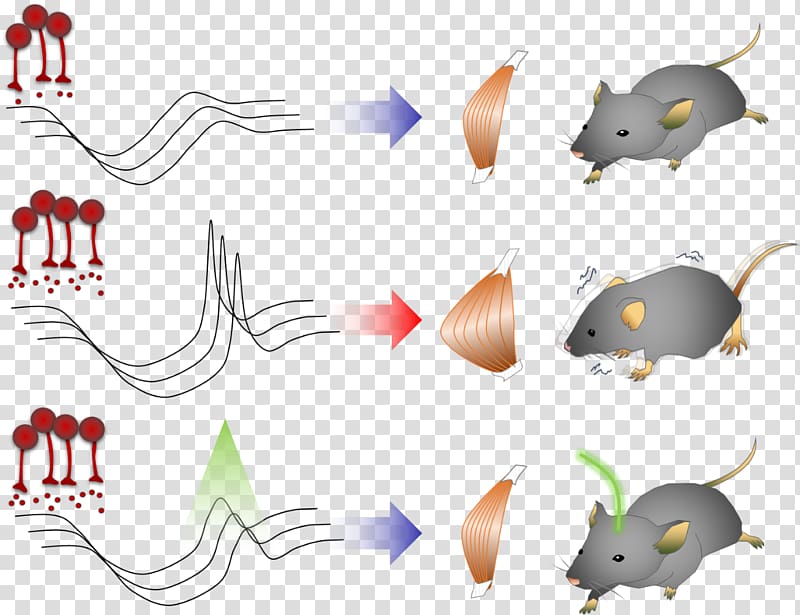 Parkinson\'s disease Basal ganglia KAIST Dystonia, basal transparent background PNG clipart