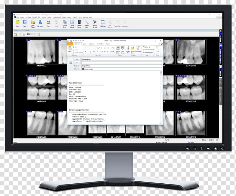 X-ray vision Computer Monitors Computer Software Display device Dental radiography, send email button transparent background PNG clipart