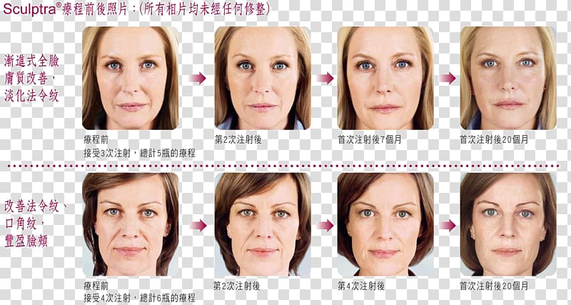 Eyebrow Cheek Nasolabial fold Botulinum toxin Forehead, nose transparent background PNG clipart