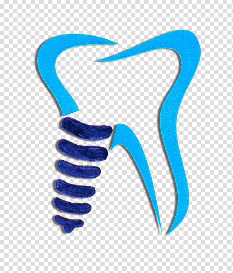 Dental Implants — Tooth Mechanix
