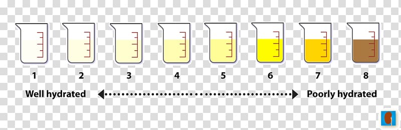 Dehydration Diet Kidney Water retention Diabetes insipidus, Urine test transparent background PNG clipart