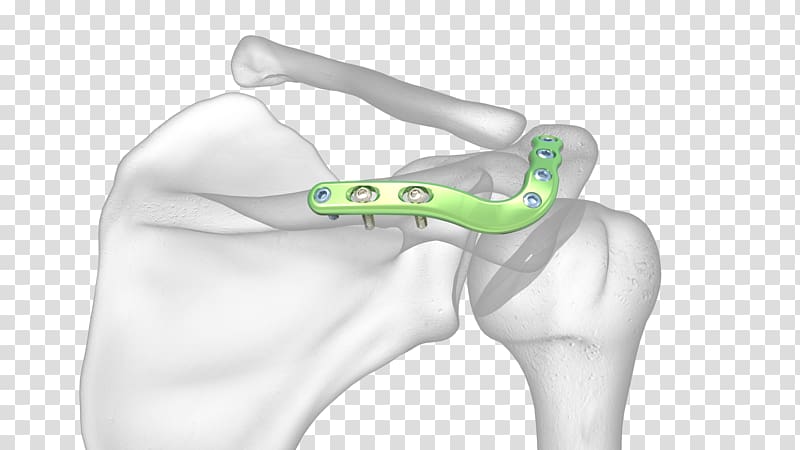 Thumb Acromion Shoulder joint Scapula, fracture definition transparent background PNG clipart