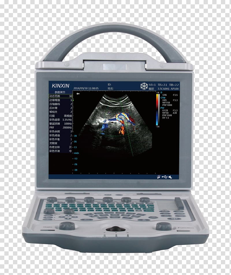 Ultrasonography Ophthalmology Equine Ultrasound Doppler echocardiography, ultra sound transparent background PNG clipart