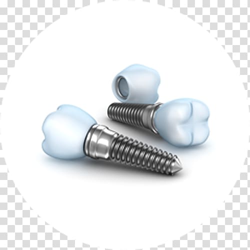 Dental implant Dentistry Oral hygiene, bridge transparent background PNG clipart