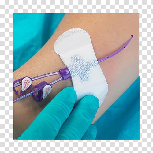 Peripherally inserted central catheter C. R. Bard Central venous catheter Medicine, others transparent background PNG clipart
