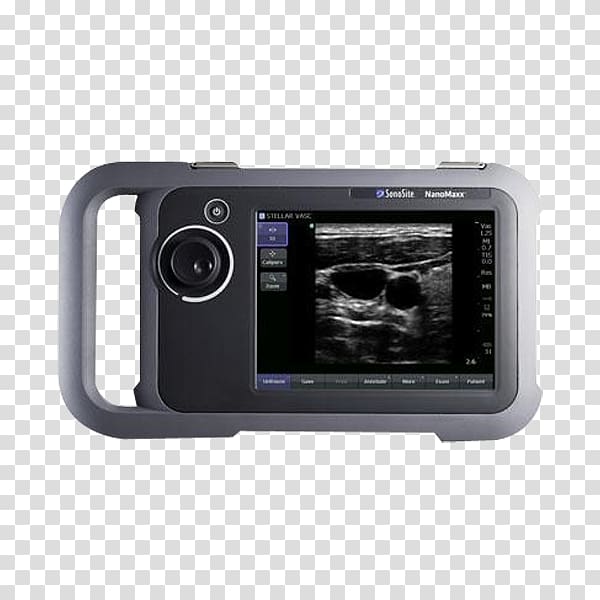 Ultrasonography Ultrasound Ecógrafo Medicine SonoSite, Inc., ultrasound machine transparent background PNG clipart