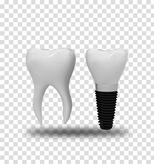 Tooth Dental implant Dentistry Orthodontics, others transparent background PNG clipart