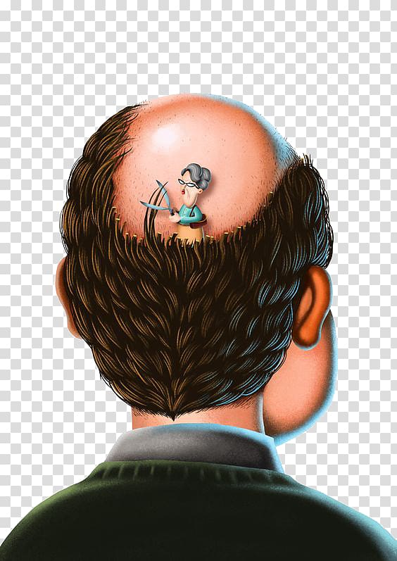 Hair loss Botak, Bald man transparent background PNG clipart