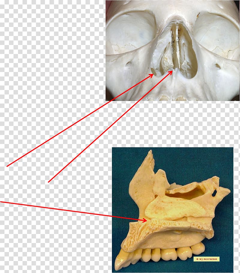 Bone Maxilla Anatomy Joint Skeletal pneumaticity, skull transparent background PNG clipart