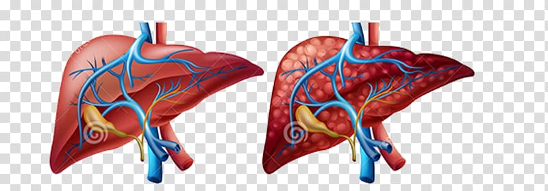 Liver Human body Diagram Cirrhosis Organ, others transparent background PNG clipart