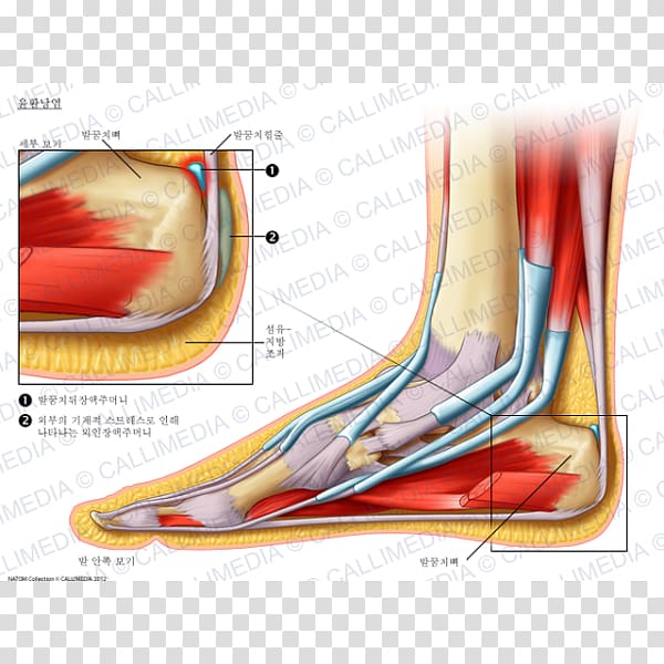 Foot Bursitis Synovial bursa Elbow Knee, others transparent background PNG clipart