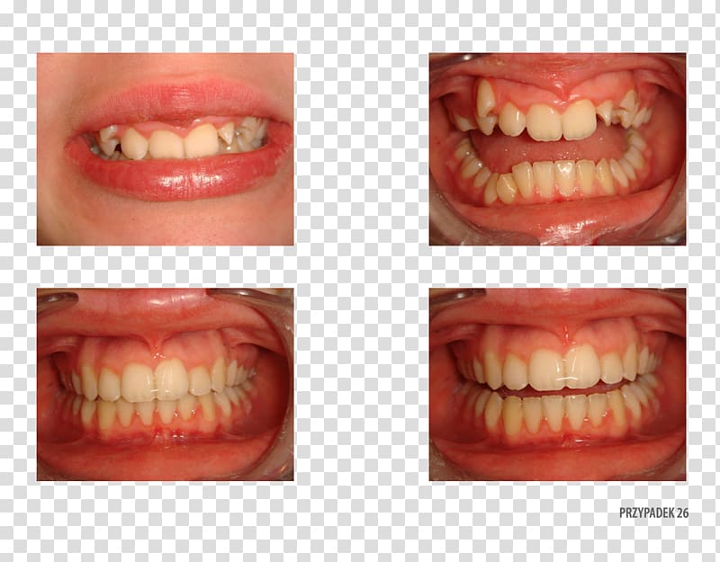 Tooth Orange Polska Close-up Therapy, orange transparent background PNG clipart