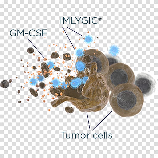 Treatment of cancer Oncolytic virus Melanoma, cancer cell transparent background PNG clipart