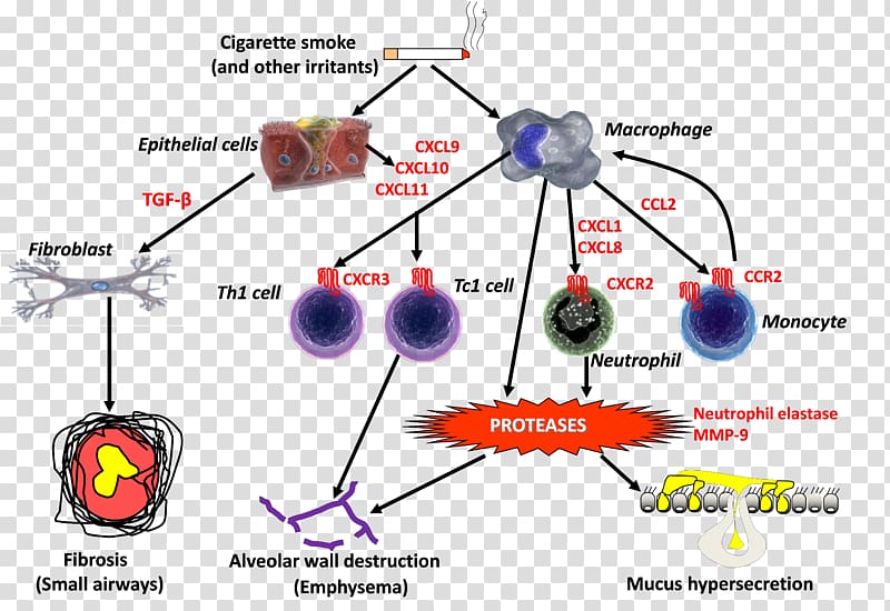 Acute exacerbation of chronic obstructive pulmonary disease Inflammation Eosinophil, others transparent background PNG clipart