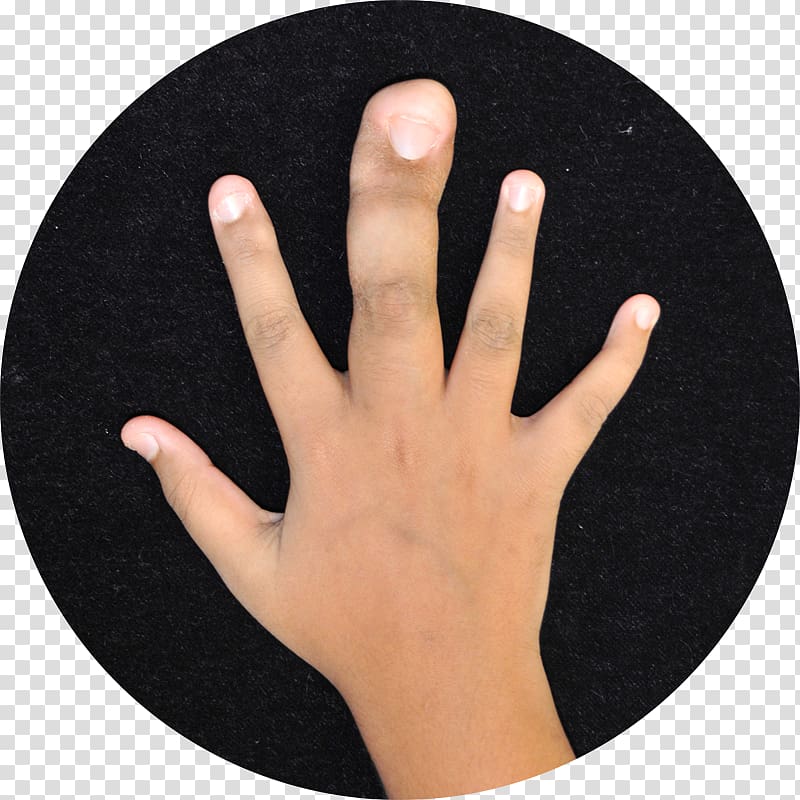 Thumb Finger Local gigantism Hand Toe, hand transparent background PNG clipart