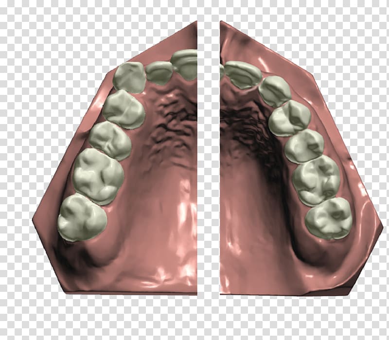 Orthodontics CAD/CAM dentistry Dental implant Dental braces, others transparent background PNG clipart