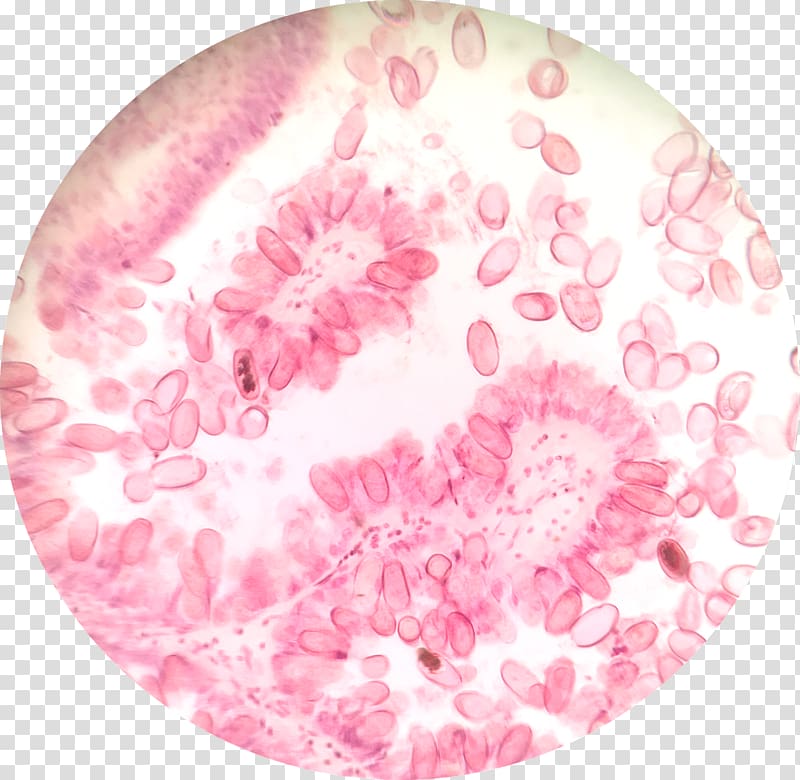 Protist Cyclospora cayetanensis Adibide Wikipedia Protozoa, liver transparent background PNG clipart
