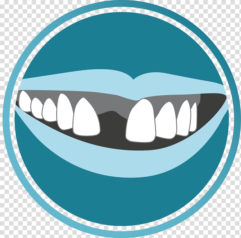 Tooth Dentistry Dental surgery Dental implant, dentistry transparent background PNG clipart