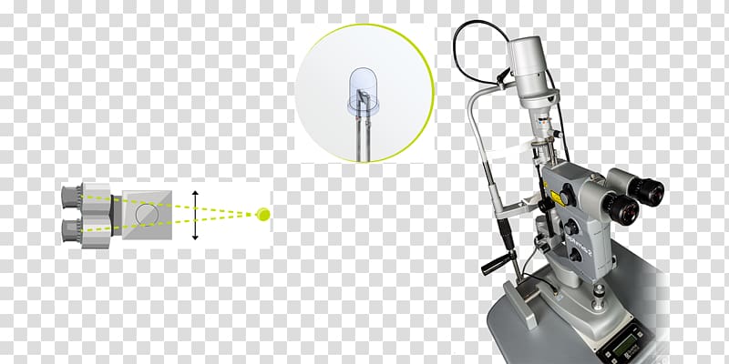 Nd:YAG laser Capsulotomy Slit lamp Iridectomy disruption, others transparent background PNG clipart