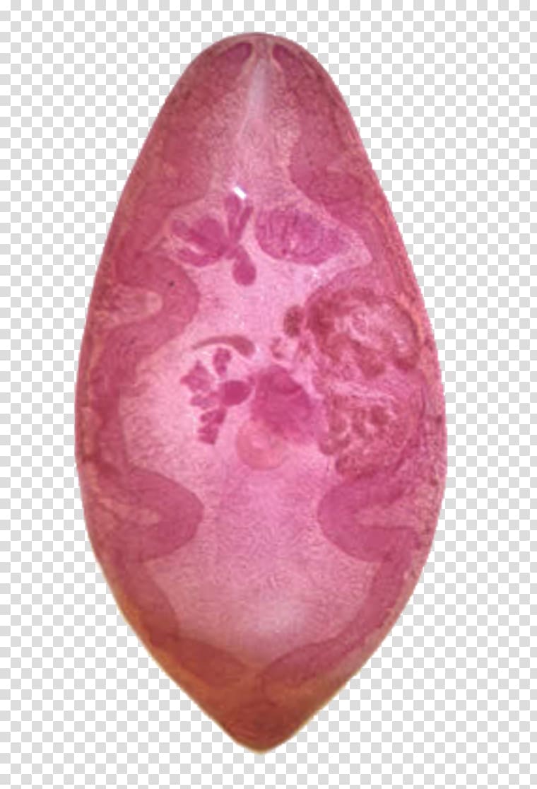 Paragonimus westermani Paragonimiasis Cutaneous larva migrans Human parasite Visceral larva migrans, human Lungs transparent background PNG clipart