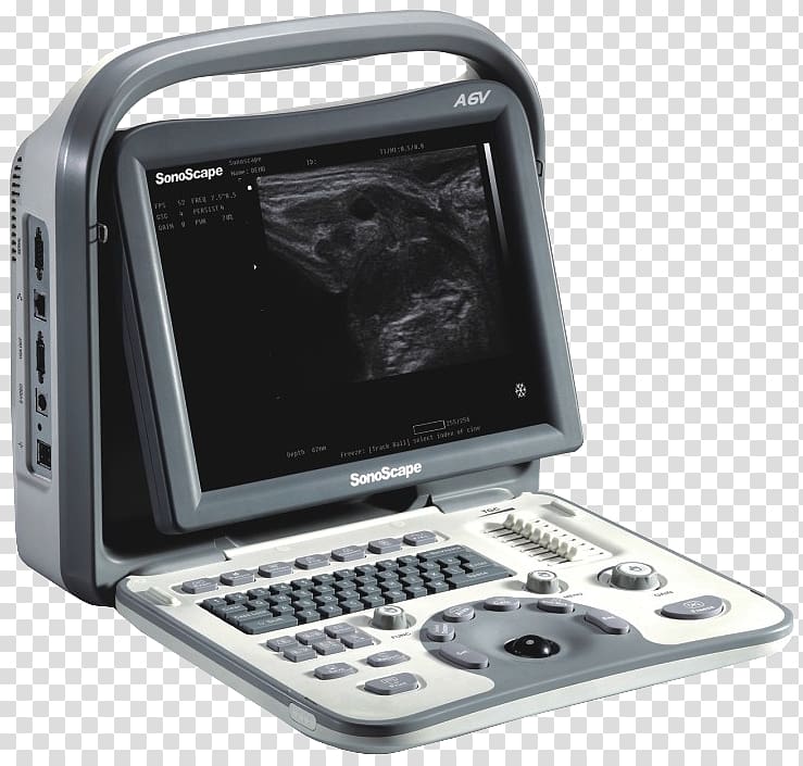Portable ultrasound Ultrasonography Doppler echocardiography Medical diagnosis, ultrasound transparent background PNG clipart