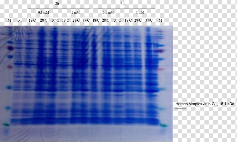 Western blot Cell SDS-PAGE Staining Polyacrylamide gel electrophoresis, Herpes Simplex Virus transparent background PNG clipart