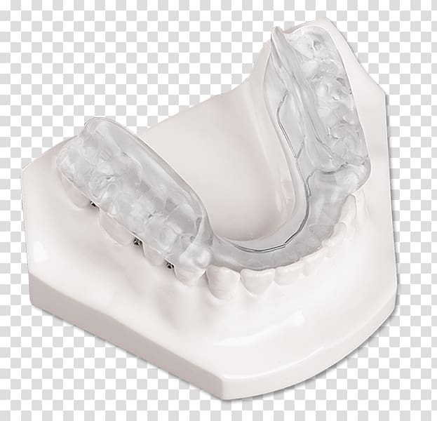 Splint Temporomandibular joint dysfunction Jaw Orthotics Twin Block Appliance, splint transparent background PNG clipart