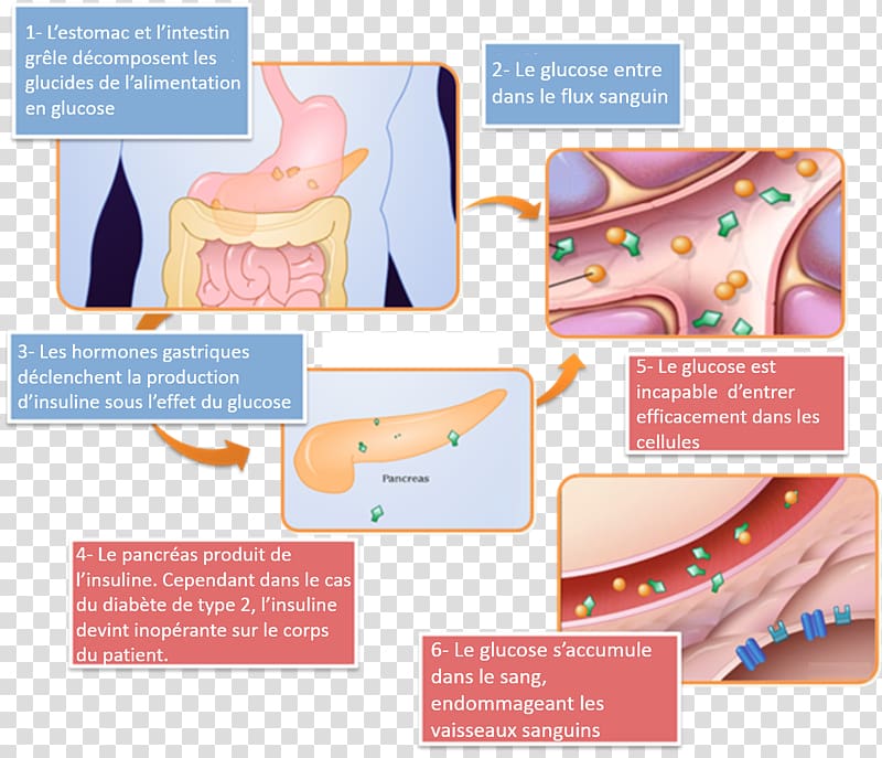 Diabetes mellitus type 2 Insulin resistance Type 1 diabetes, others transparent background PNG clipart